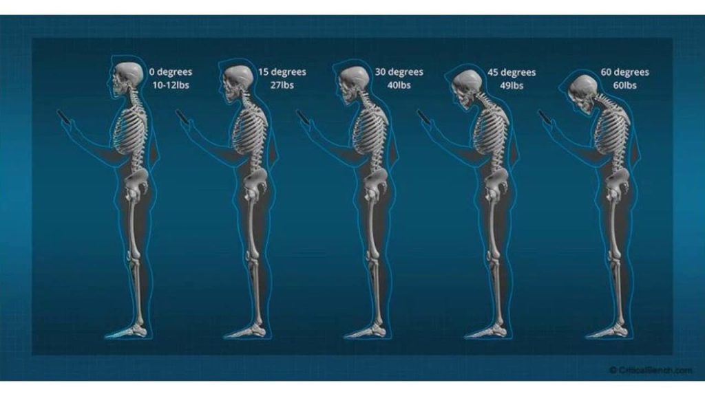 The Impact of Crane Neck Posture on Everyday Health